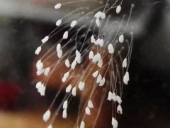 优昙婆罗花