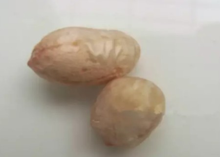 花生盆栽种植方法3